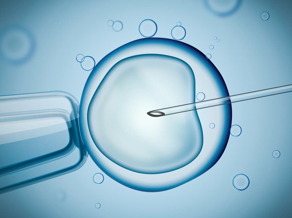 Intracytoplasmic Sperm Injection (ICSI)